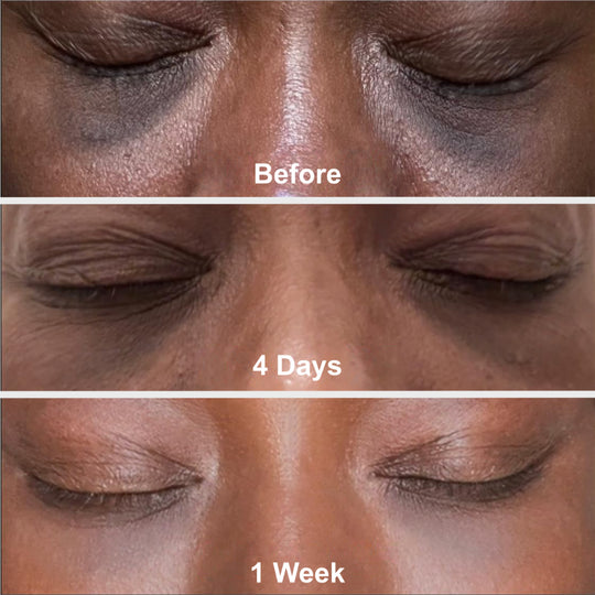 Daily Shield - Tinted Mineral SPF 50
