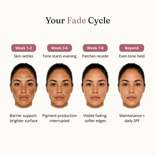 Melasma Recovery Cream